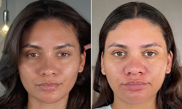 Cú sốc "mặt phá nét" của nữ Influencer trong lần đầu mang thai