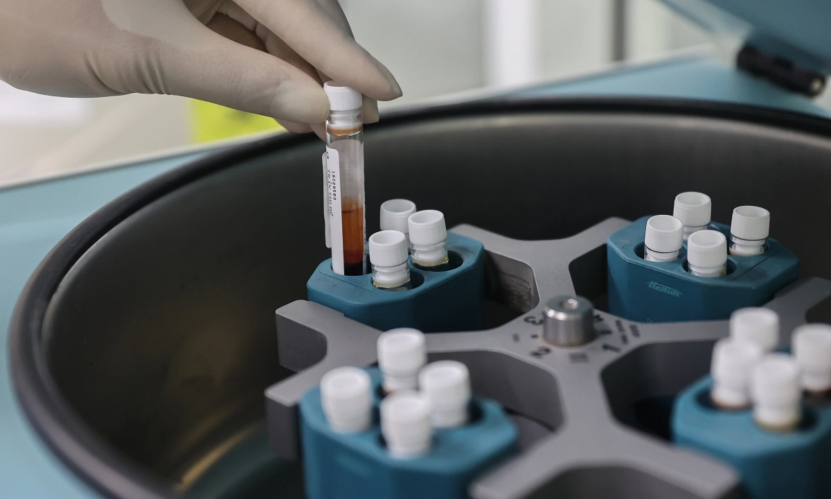 Vòng eo to tàn phá nội tạng thế nào