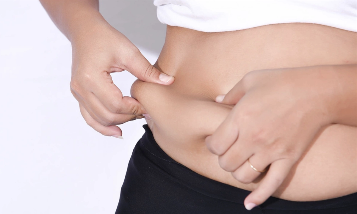 Chuyên gia chỉ ra 4 'thủ phạm' khiến bụng tích mỡ, chảy xệ