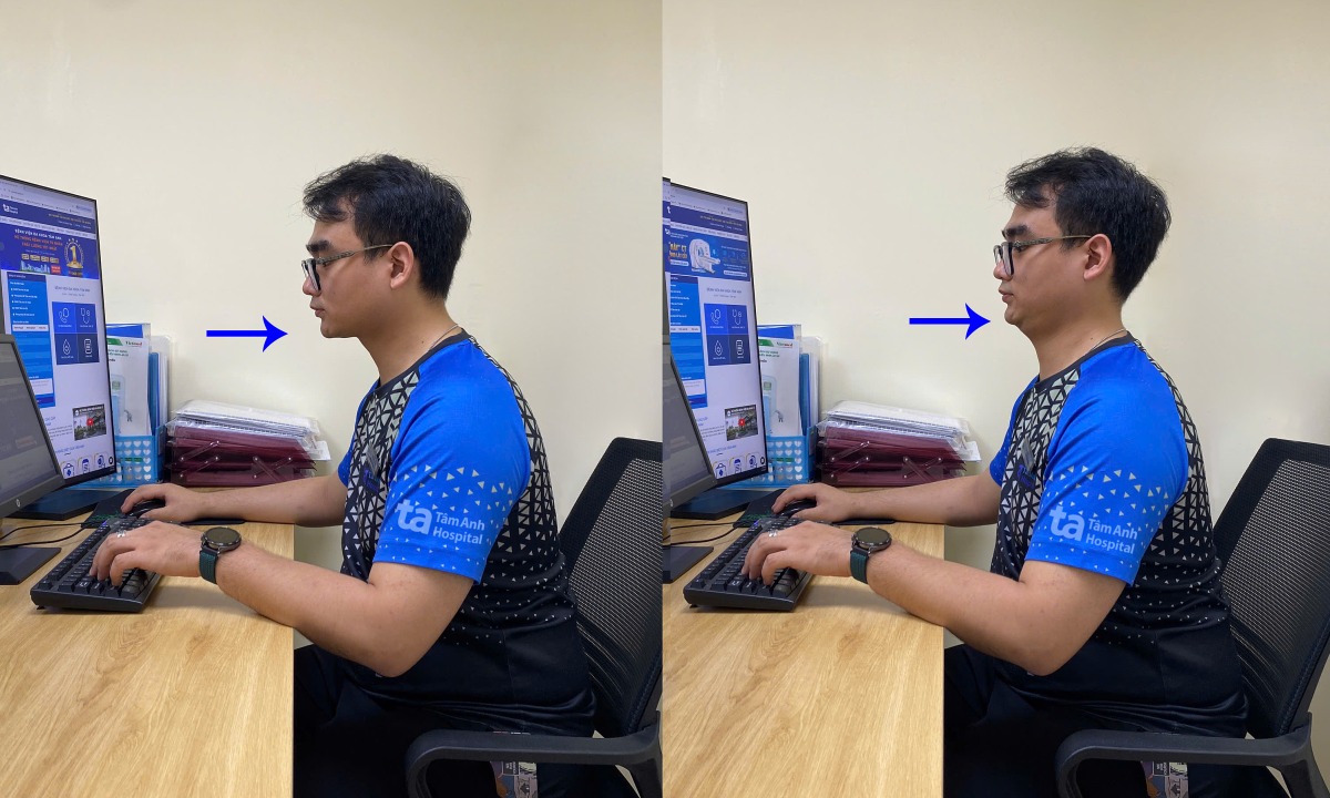 Ba bài tập giảm mỏi cổ vai gáy tại bàn cho dân văn phòng