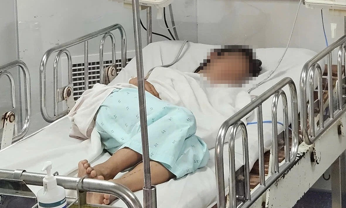 Những dấu hiệu bệnh não mô cầu dễ bỏ qua