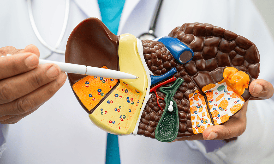 Chàng trai khỏi xơ hóa gan nhờ bỏ thói quen uống trà sữa