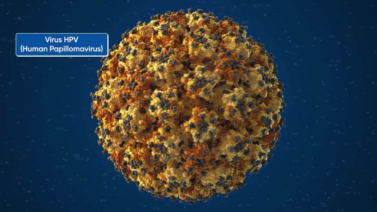 Nhiễm HPV có phải sẽ mắc ung thư?