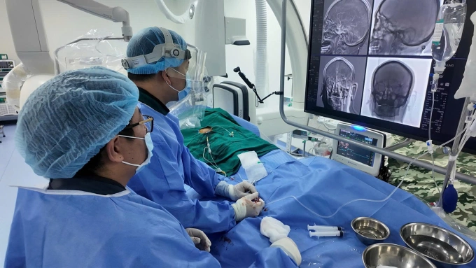Bác sĩ Hà và kíp đang thực hiện kỹ thuật can thiệp mạch não trên người bệnh. Ảnh: Bác sĩ cung cấp