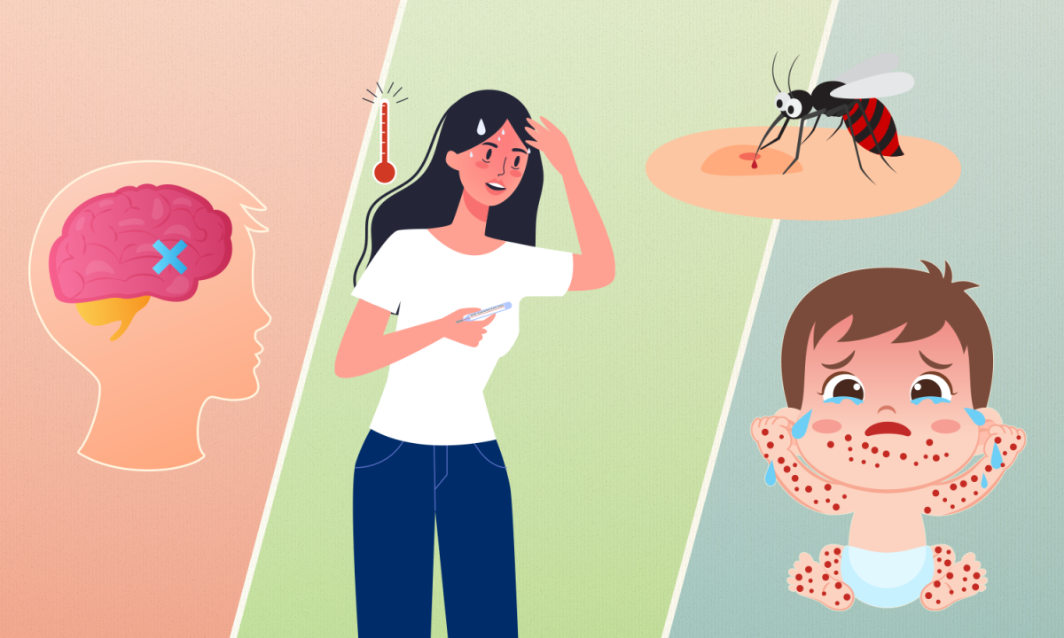 Nhận biết dấu hiệu não mô cầu, sốt xuất huyết và tay chân miệng