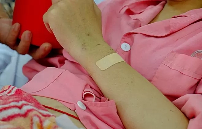 Triệu chứng mơ hồ khiến người mắc lupus ban đỏ lỡ thời gian vàng điều trị