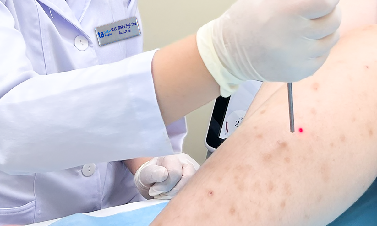 Viêm da sau tẩy lông