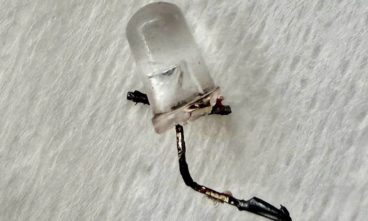 Bác sĩ xoay từng mm gắp bóng đèn LED khỏi phổi bé gái