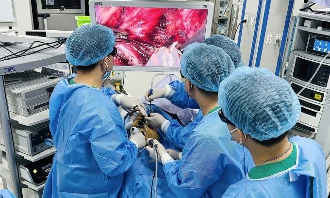 Các bác sĩ thực hiện ca mổ nội soi 3D cắt thực quản kết hợp nạo vét hạch 3 vùng cổ - ngực - bụng. Ảnh: Thái Hà