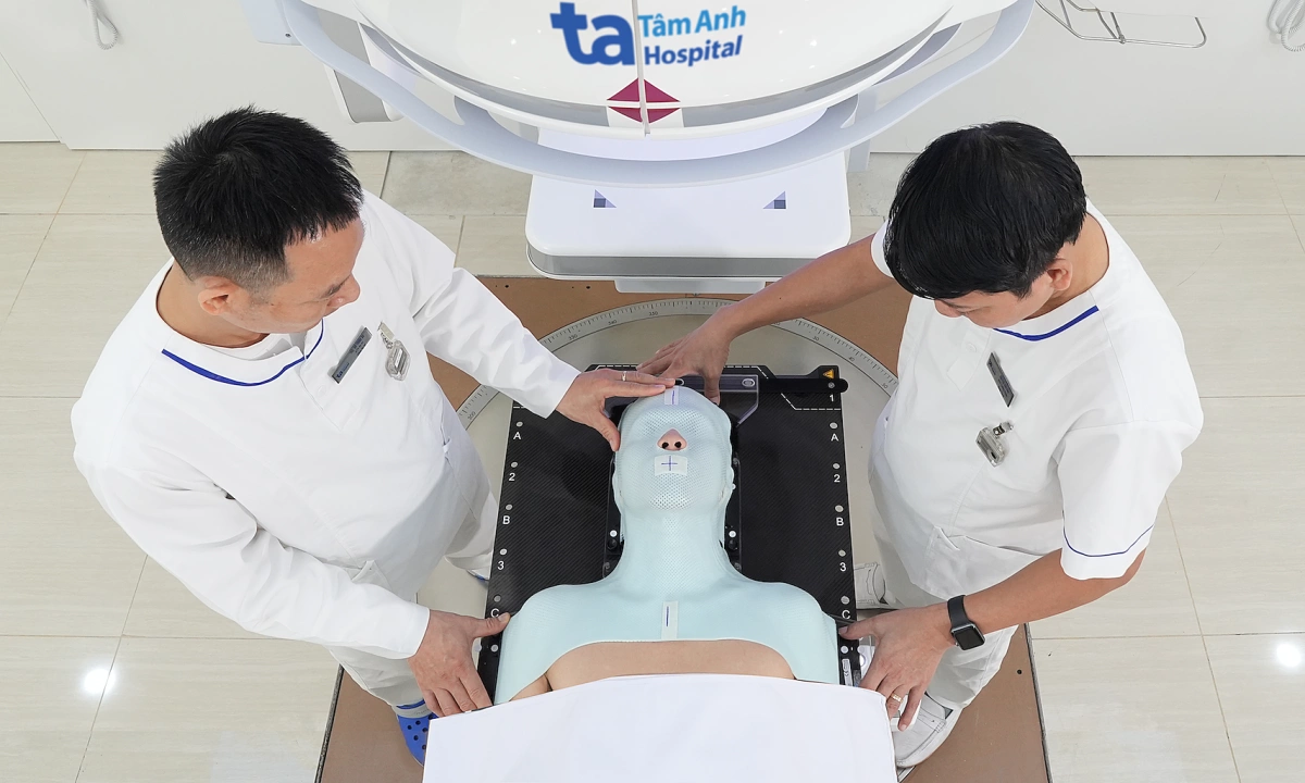 Xạ trị có thể triệt căn ung thư vòm họng không?