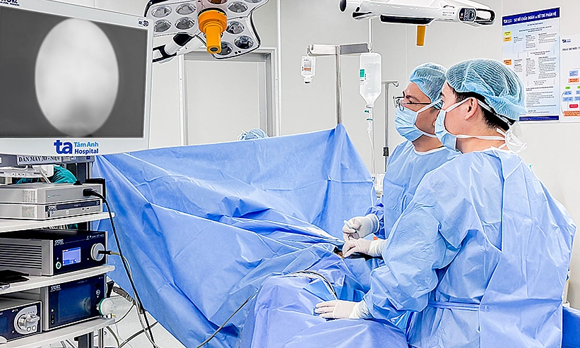 Stent niệu quản di lệch lên thận