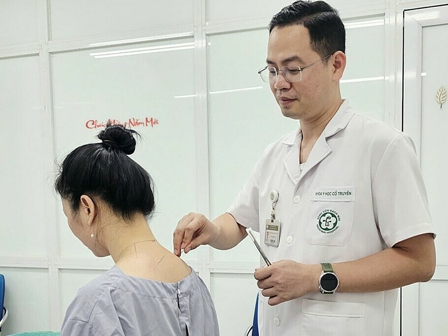 Châm cứu chữa đau cổ vai gáy