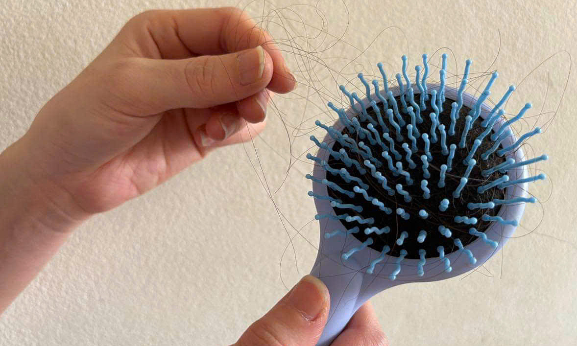 Bốn thời điểm phái đẹp dễ rụng tóc