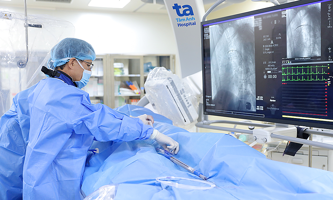 Loét động mạch chủ không triệu chứng