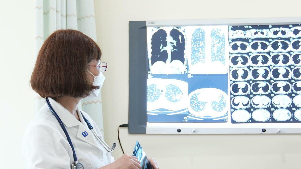 Làm gì phòng lây lao phổi khi sống chung với người bệnh?
