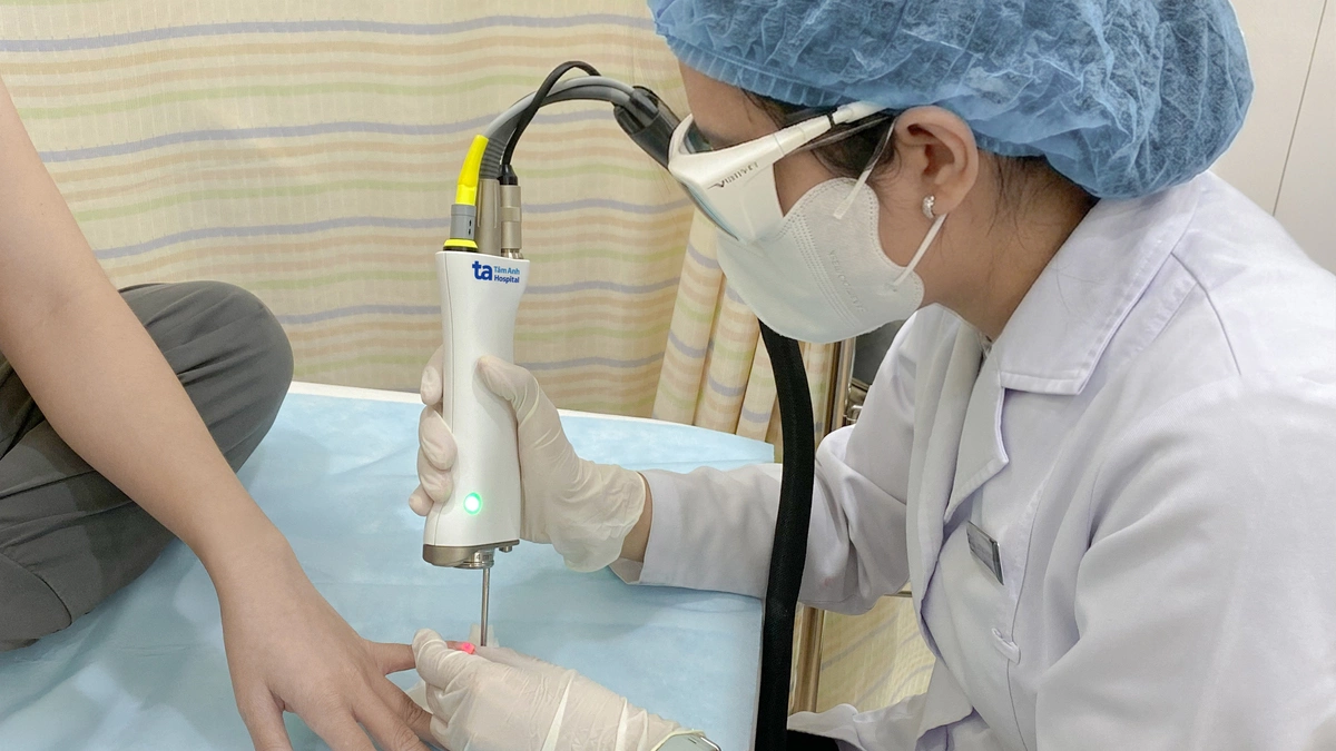 Thuốc kết hợp laser điều trị nấm móng