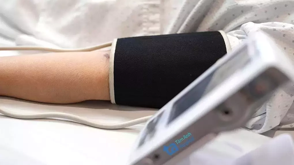 4 lý do nên đo huyết áp thường xuyên