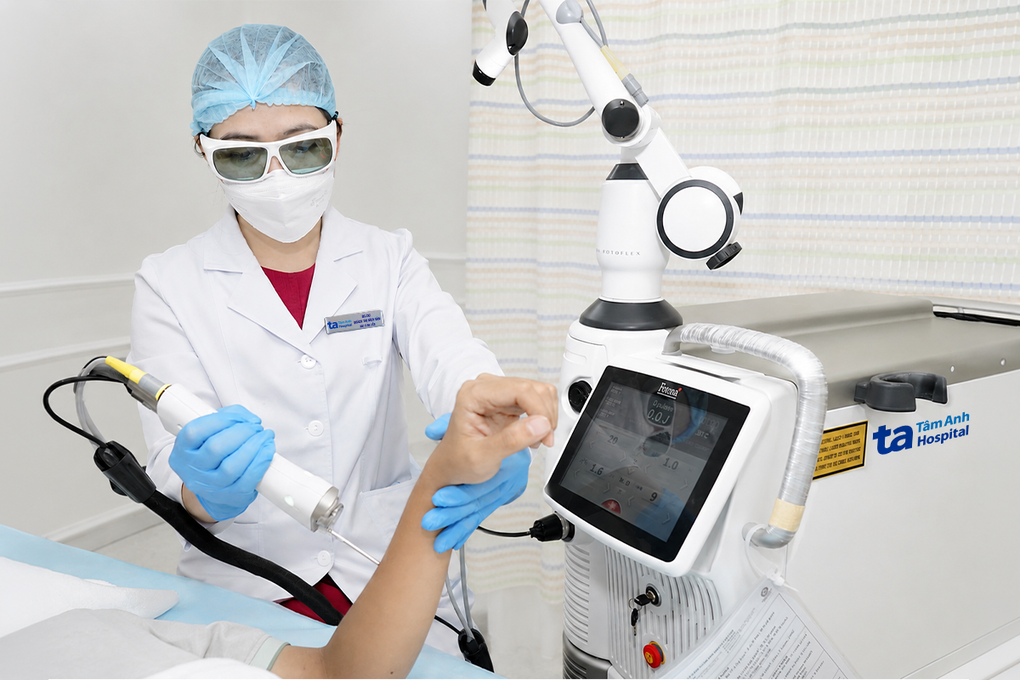 Từng bị áp xe da có triệt lông bằng laser? 2 Bác sĩ sử dụng laser 6D triệt lông cho một phụ nữ. Ảnh: Bệnh viện Đa khoa Tâm Anh