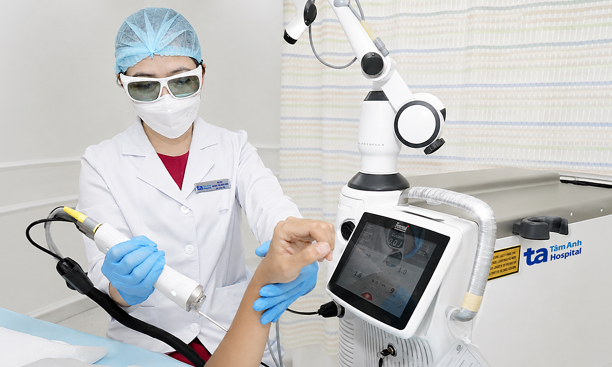 Từng bị áp xe da có triệt lông bằng laser?