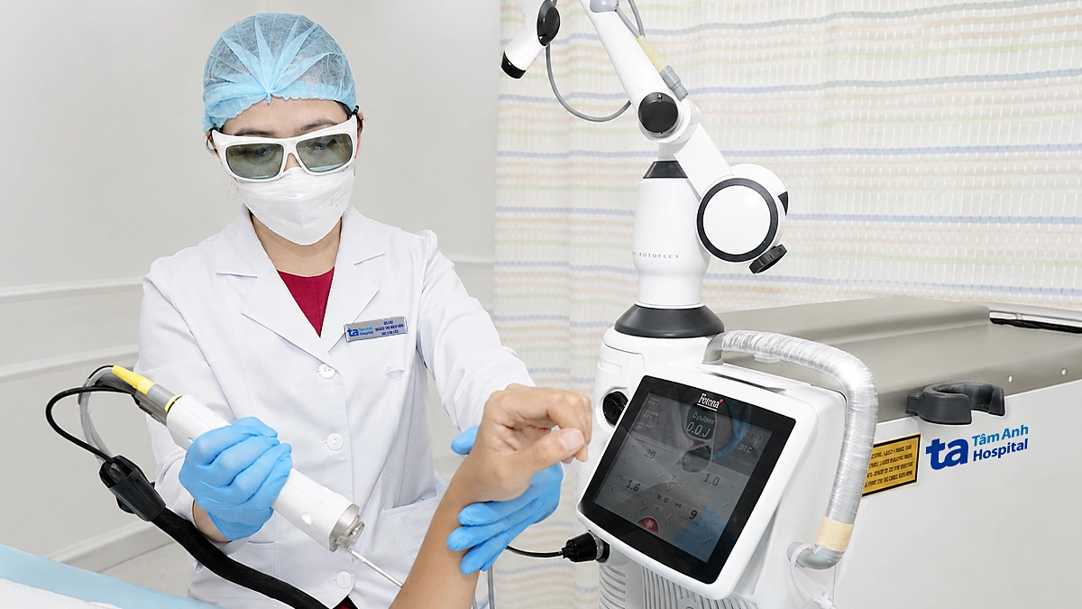 Từng bị áp xe da có triệt lông bằng laser?