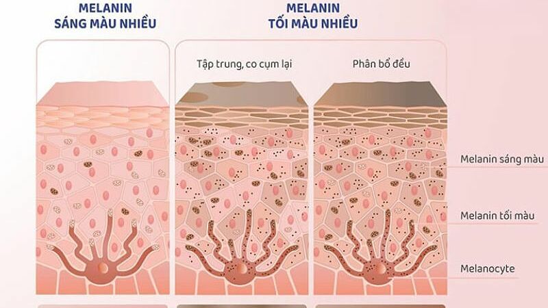 Ba lầm tưởng về sắc tố da melanin