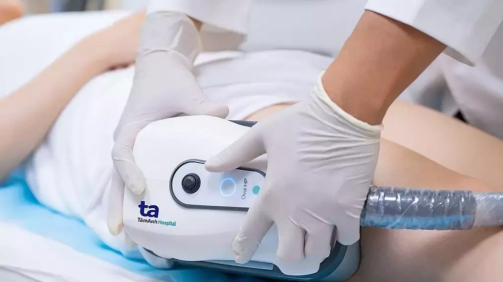 Công nghệ đông hủy mỡ có dùng được ở bắp tay?