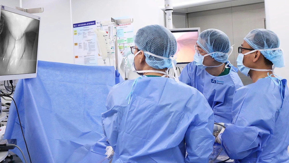 Sỏi nằm dọc ống tụy người phụ nữ