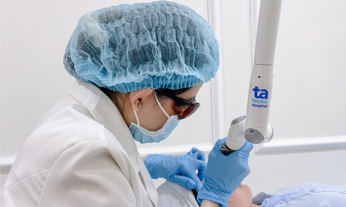 Dùng laser xóa xăm chân mày