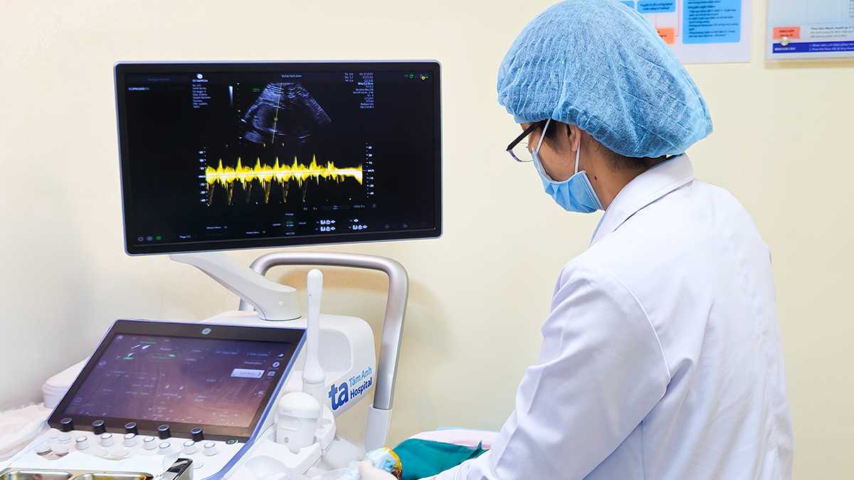 Sinh thiết gai nhau phát hiện thai nhi bất thường nhiễm sắc thể