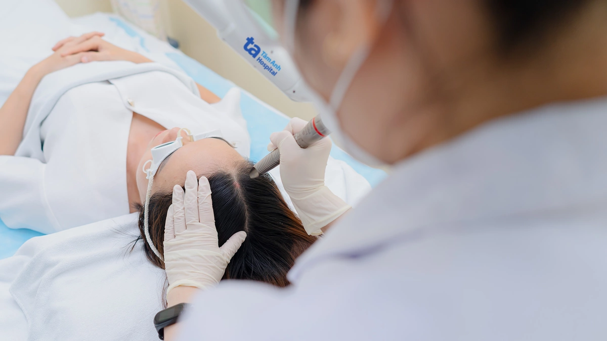Hói trán kiểu "bò liếm" điều trị thế nào