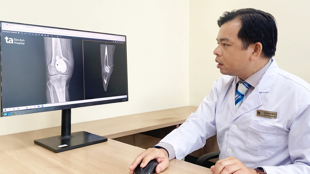 U phá hủy xương khớp gối người đàn ông