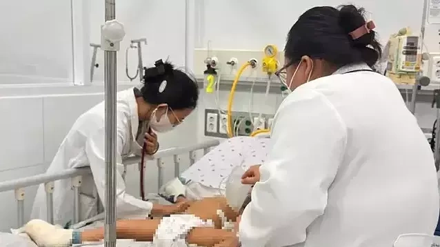 Hai anh em được bố mẹ cứu khỏi xe khách cháy qua cơn nguy kịch
