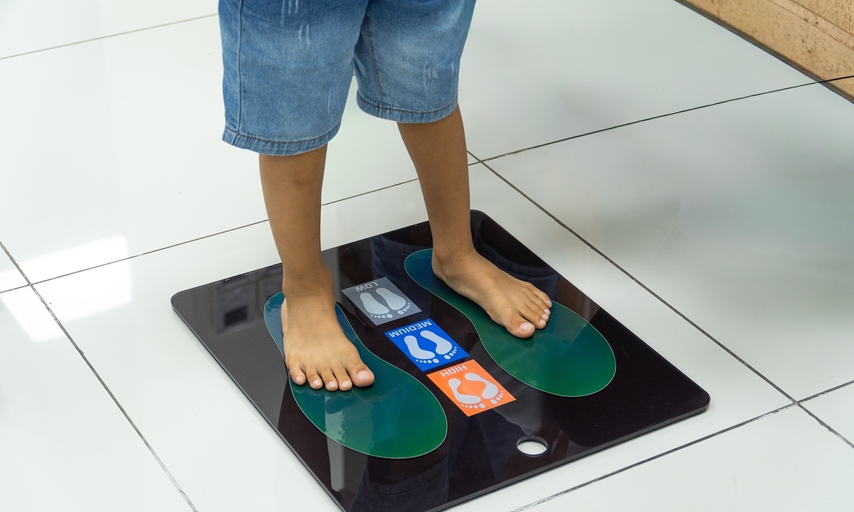 Dấu hiệu trẻ bị bàn chân bẹt và cách điều trị