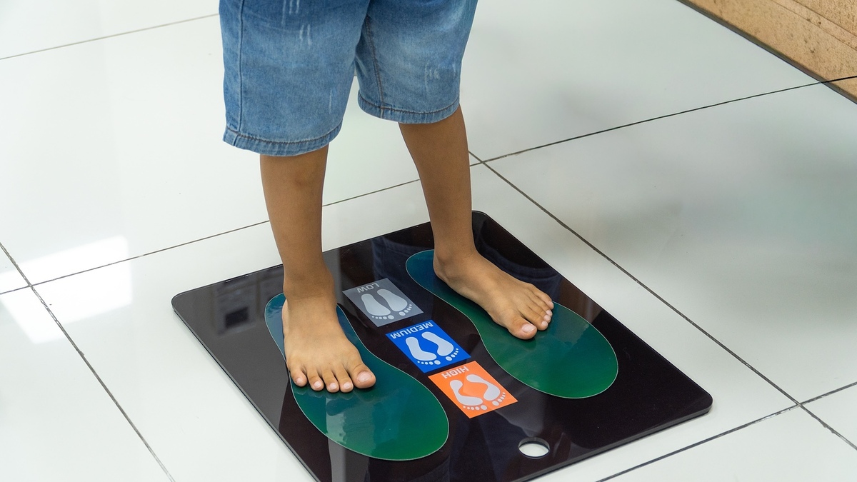 Dấu hiệu trẻ bị bàn chân bẹt và cách điều trị