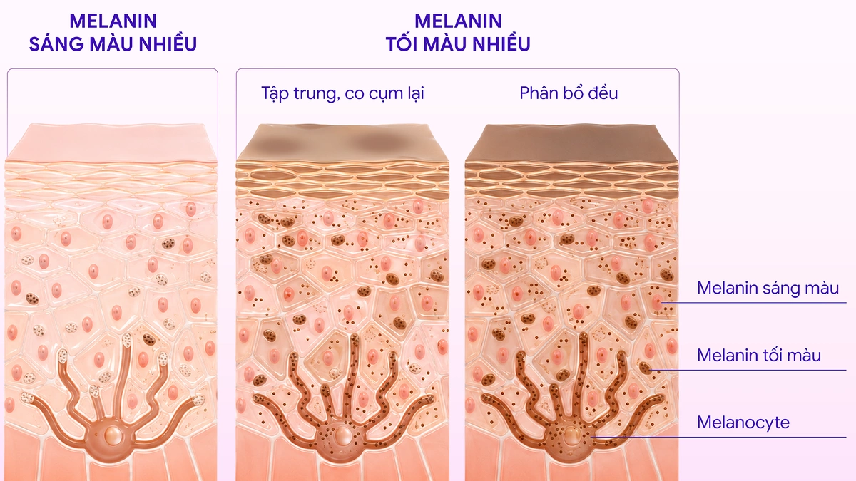 Nám da hình thành như thế nào