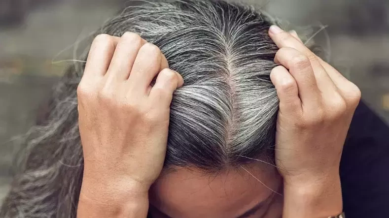 Vì sao chưa già mà tóc đã bạc?