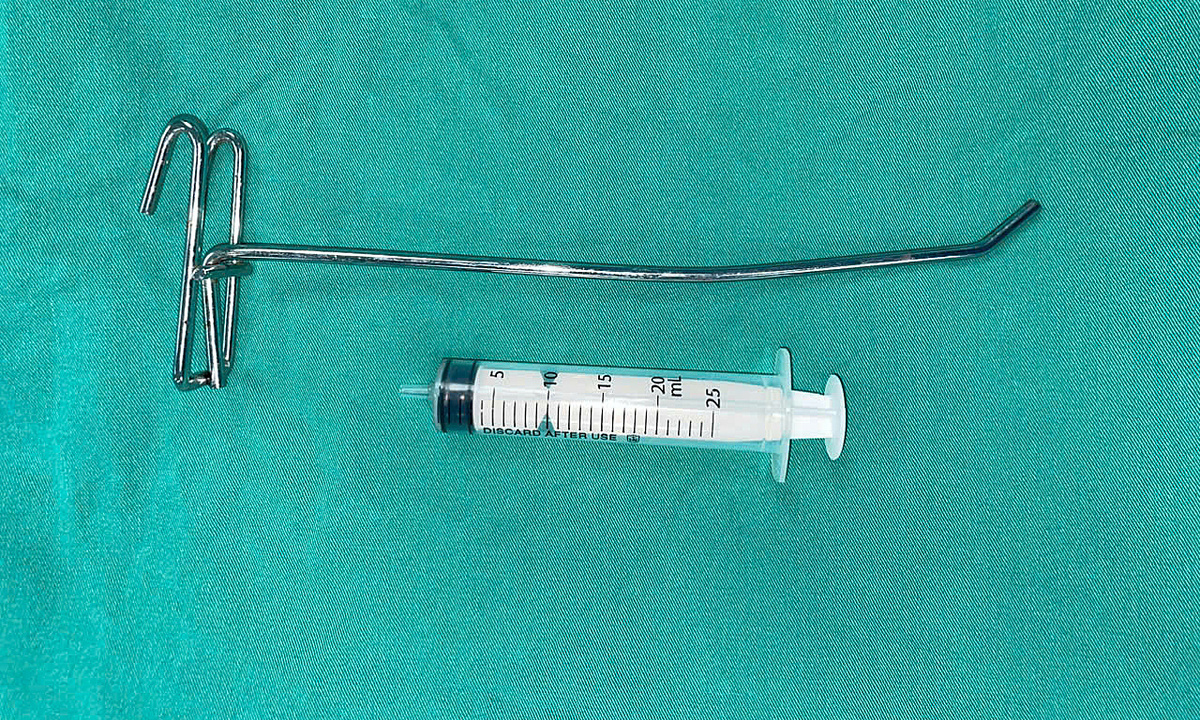 Cứu chàng trai bị thanh sắt đâm vào mắt