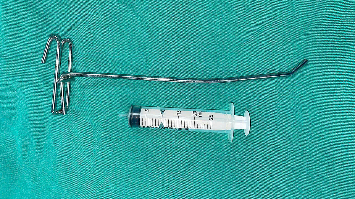 Cứu chàng trai bị thanh sắt đâm vào mắt