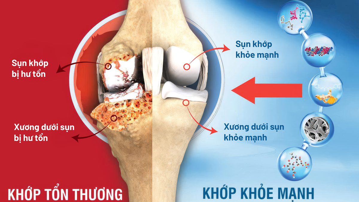 Vì sao thời tiết thay đổi lại đau khớp?