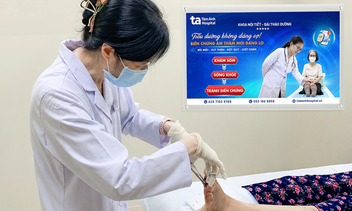Hoại tử chân do biến chứng tiểu đường