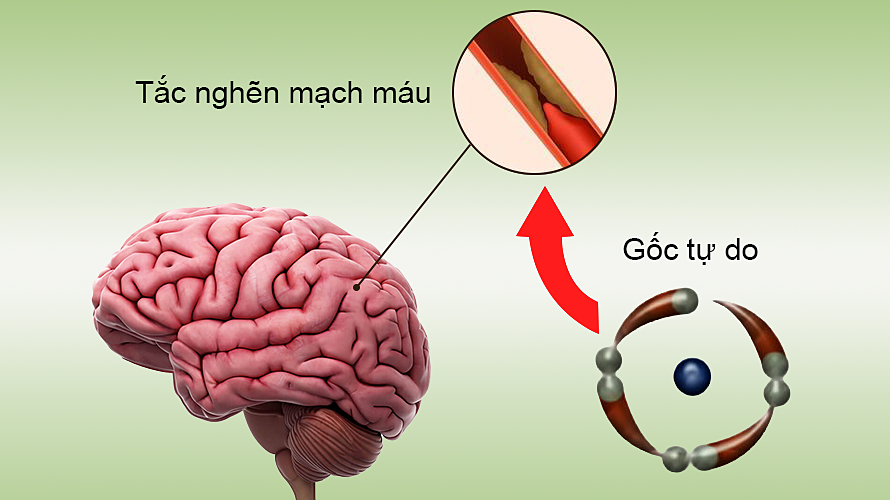 Gốc tự do tấn công gây hại não thế nào