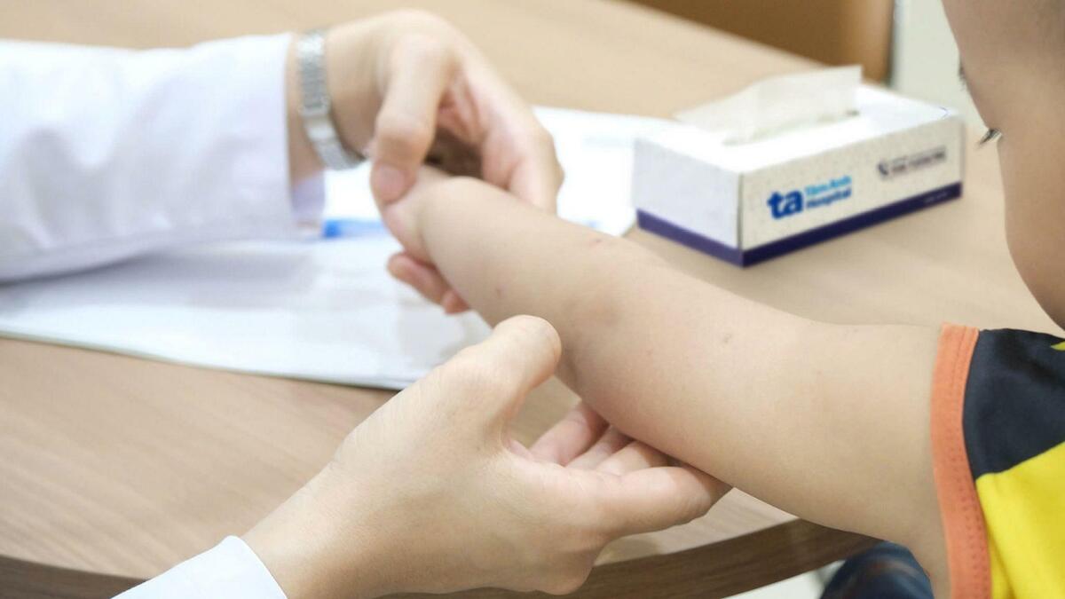 Trẻ nổi mẩn đỏ có phải dị ứng?
