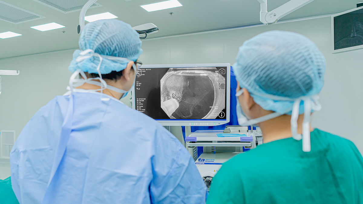 Nuốt nghẹn do co thắt tâm vị