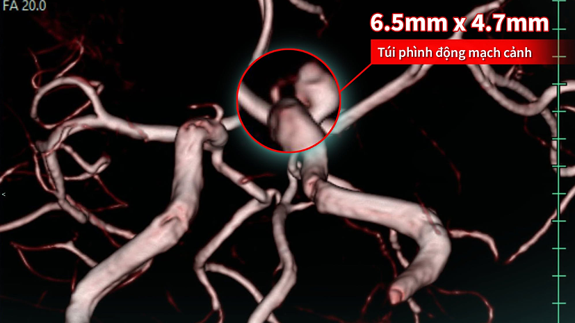 Trì hoãn khám sức khỏe để ưu tiên chăm sóc gia đình