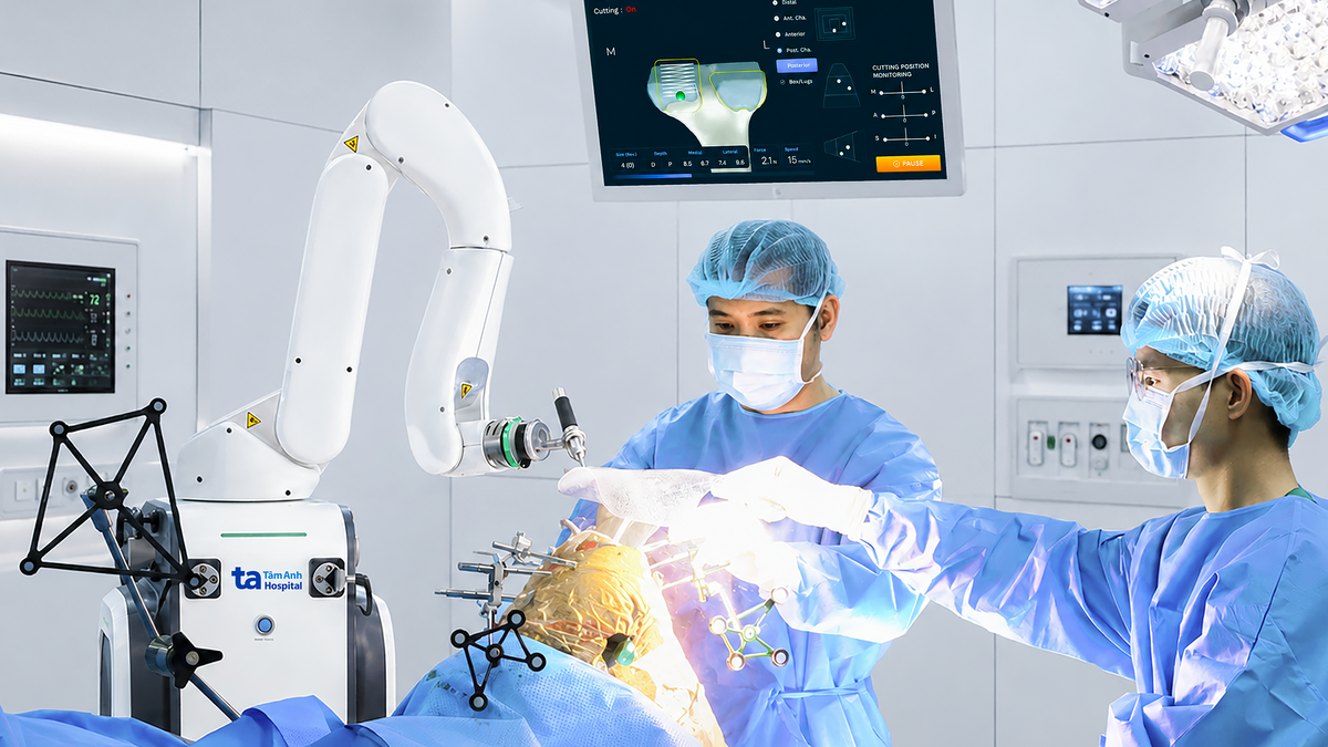 Robot AI thay khớp gối cho người phụ nữ cấu trúc xương lớn