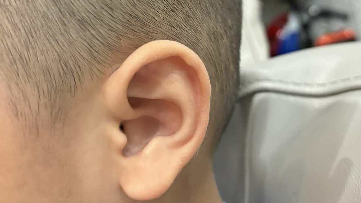 Điều gì xảy ra khi vệ sinh tai thường xuyên?