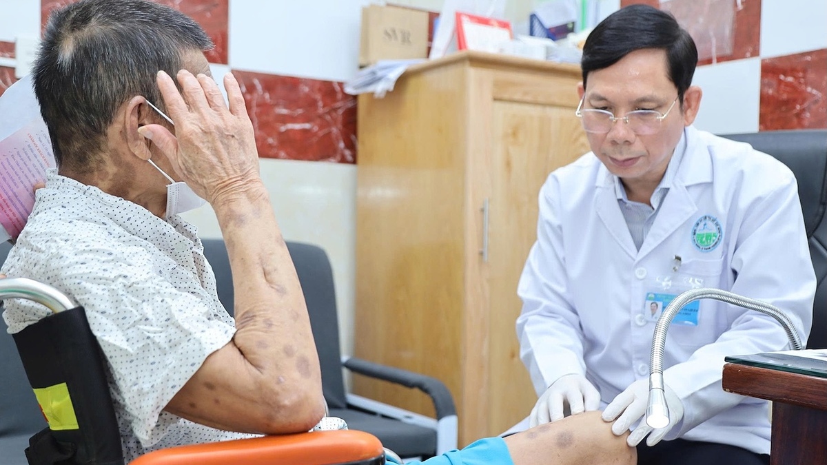 "Ác mộng" đau thần kinh sau khi bệnh zona lành