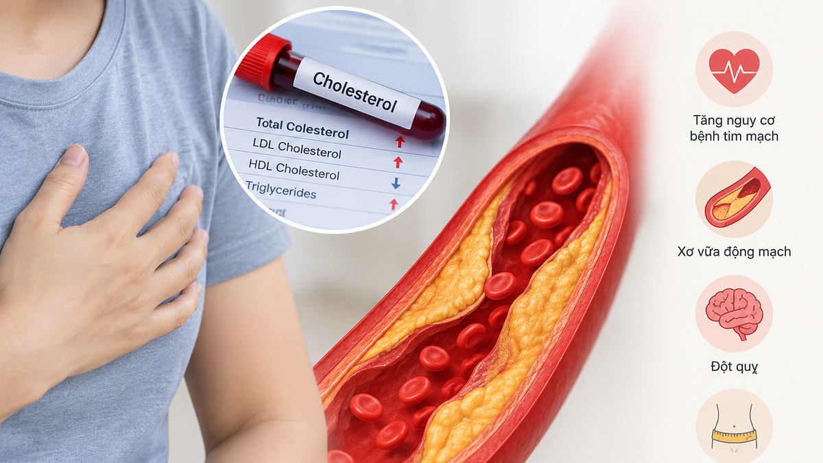 Vai trò của cholesterol đối với cơ thể
