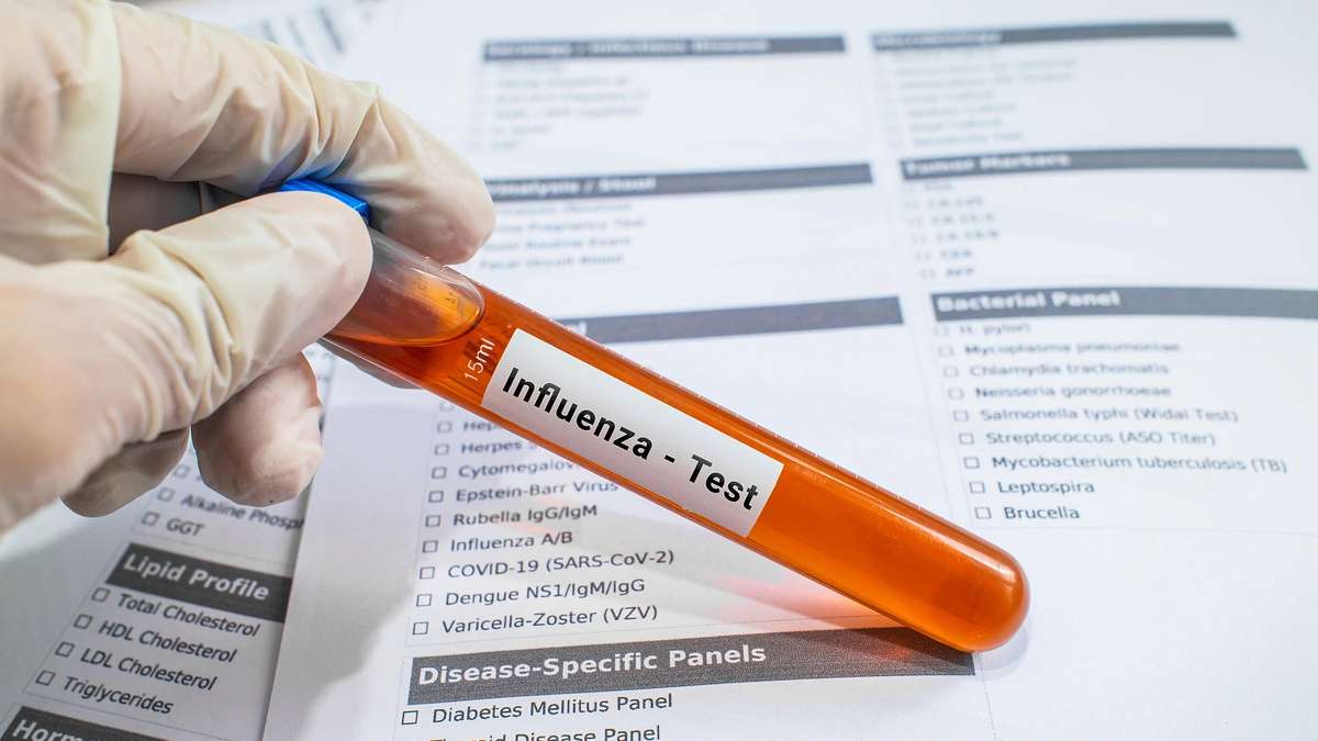 Giới khoa học theo dõi biến đổi của H1N1 để dự báo mùa cúm