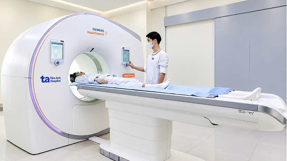 Đau đầu kéo dài có phải dấu hiệu túi phình mạch máu não?